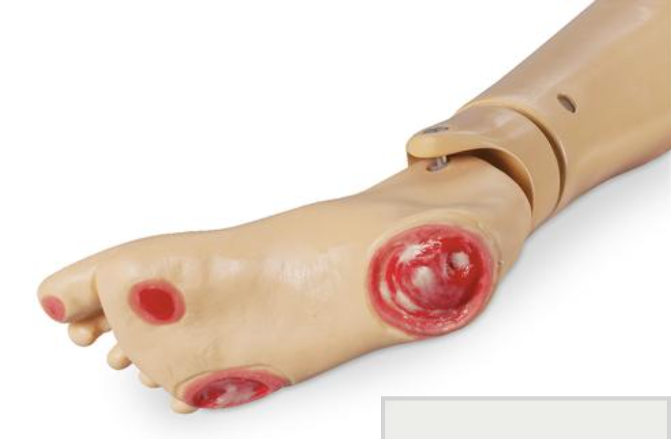 Dekubitusfuß für Krankenpflegepuppe